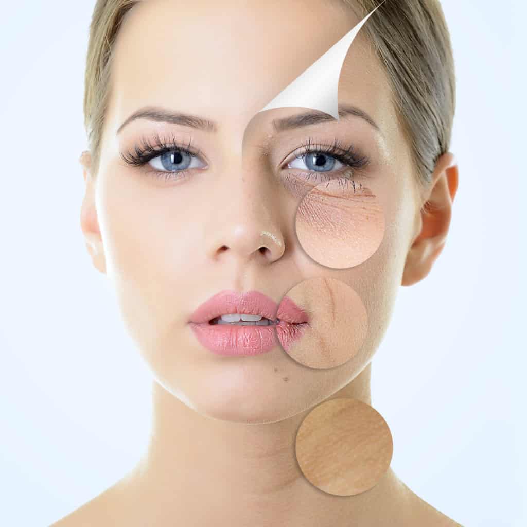 What Does Sculptra Do for the Skin?