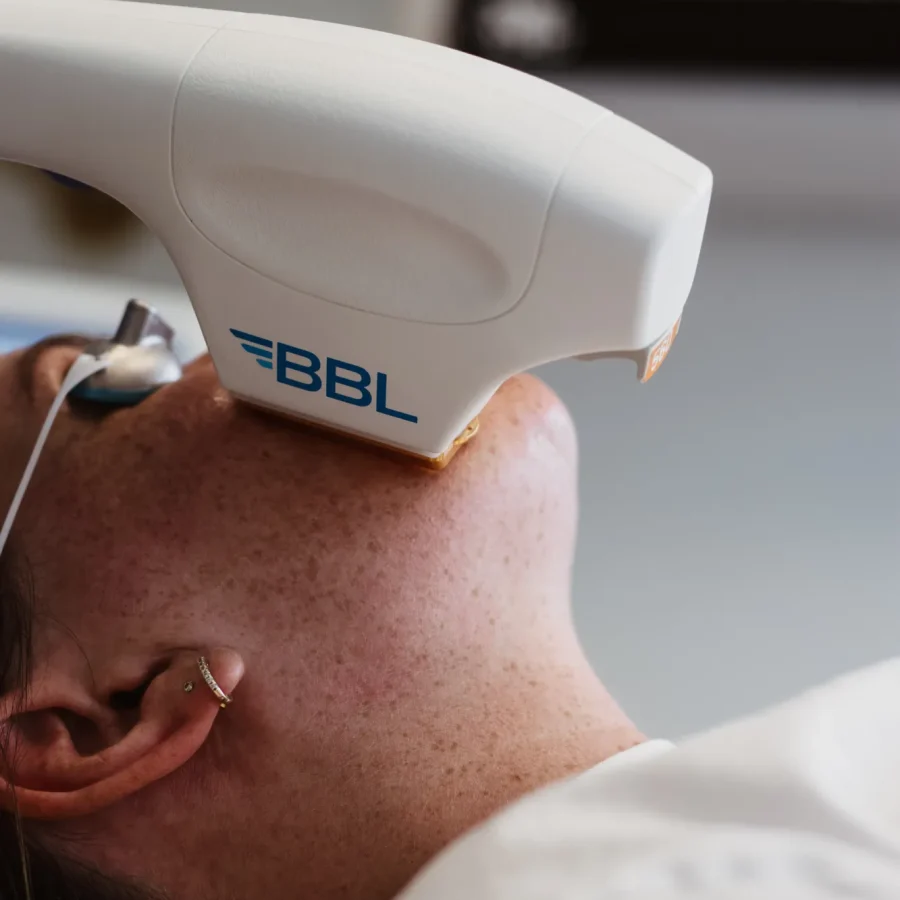 BBL-candi-at-central-oregon-aesthetics-in-bend-or