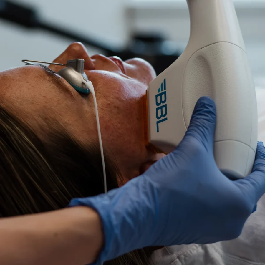 BBL-sec-at-central-oregon-aesthetics-in-bend-or