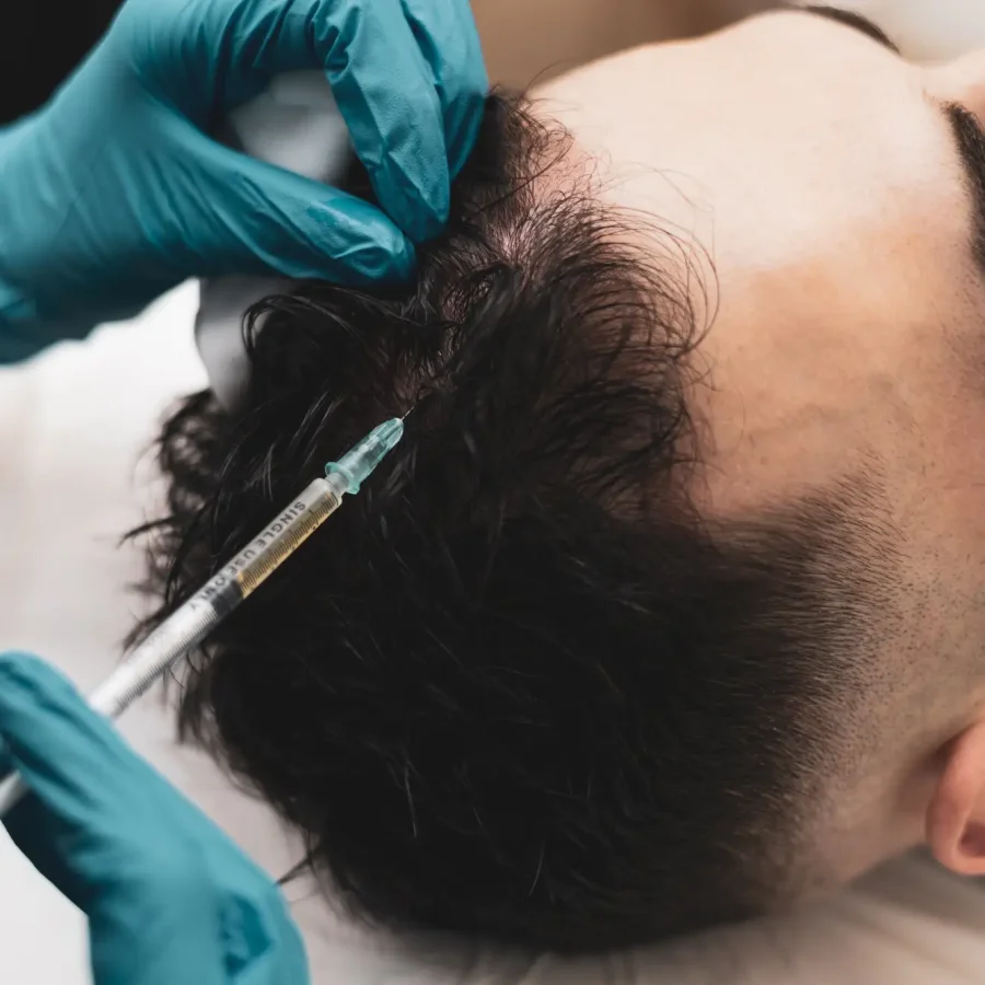 PRF injection benfit-by-Central-Oregon-Aesthetics-in-Bend-OR