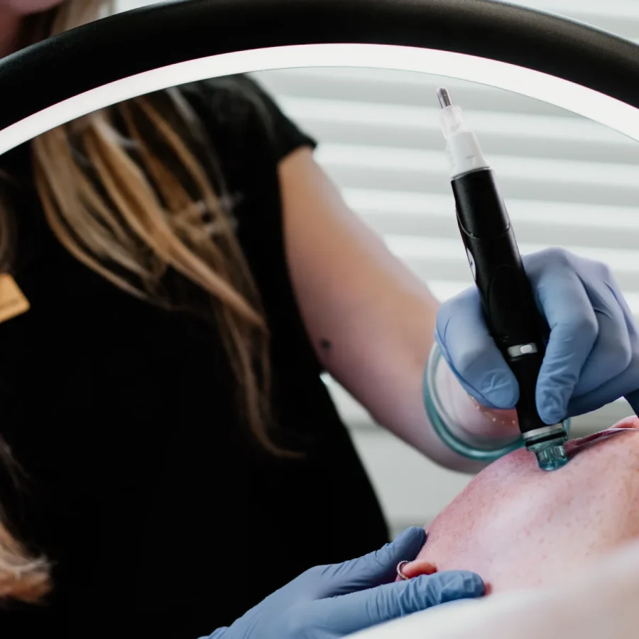 hydra-sec-at-central-oregon-aesthetics-in-bend-or