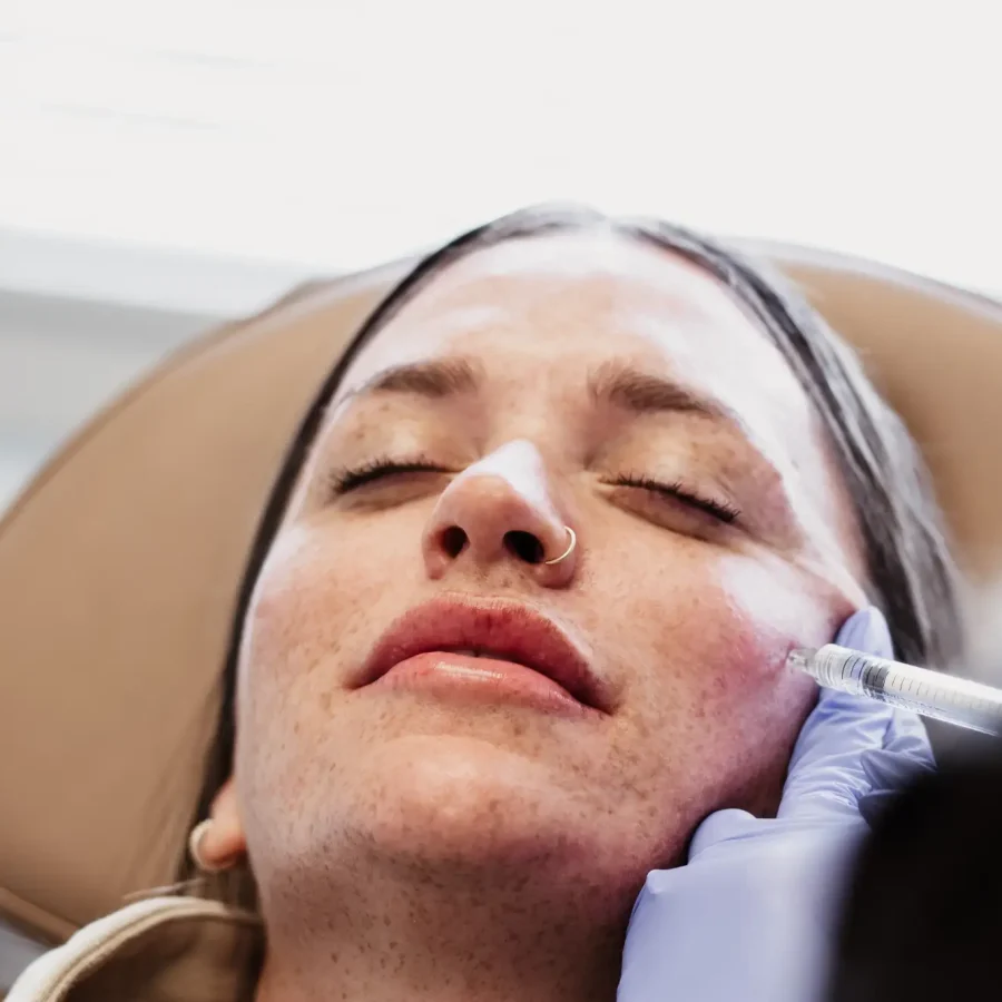 lip-filler-benefits-at-central-oregon-aesthetics-in-bend-or