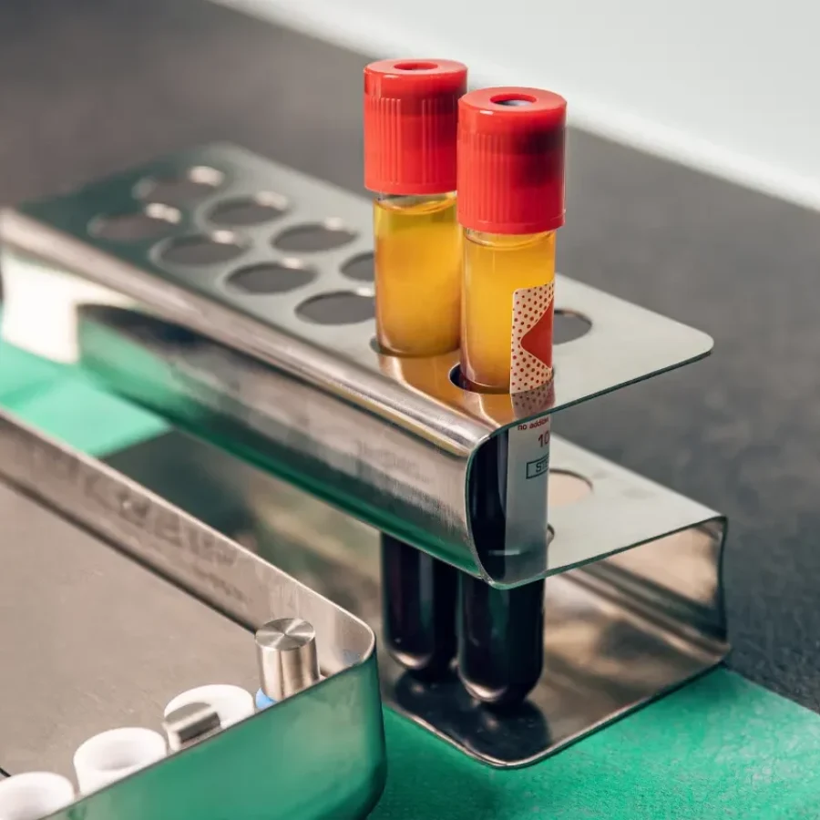 prf-injections-sec-at-central-oregon-aesthetics-in-bend-or