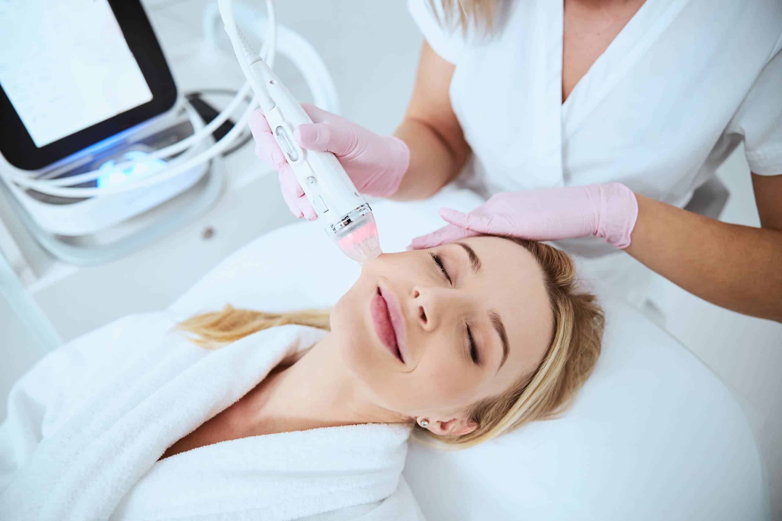 How To Take Care Of Your Skin After Skinpen Microneedling